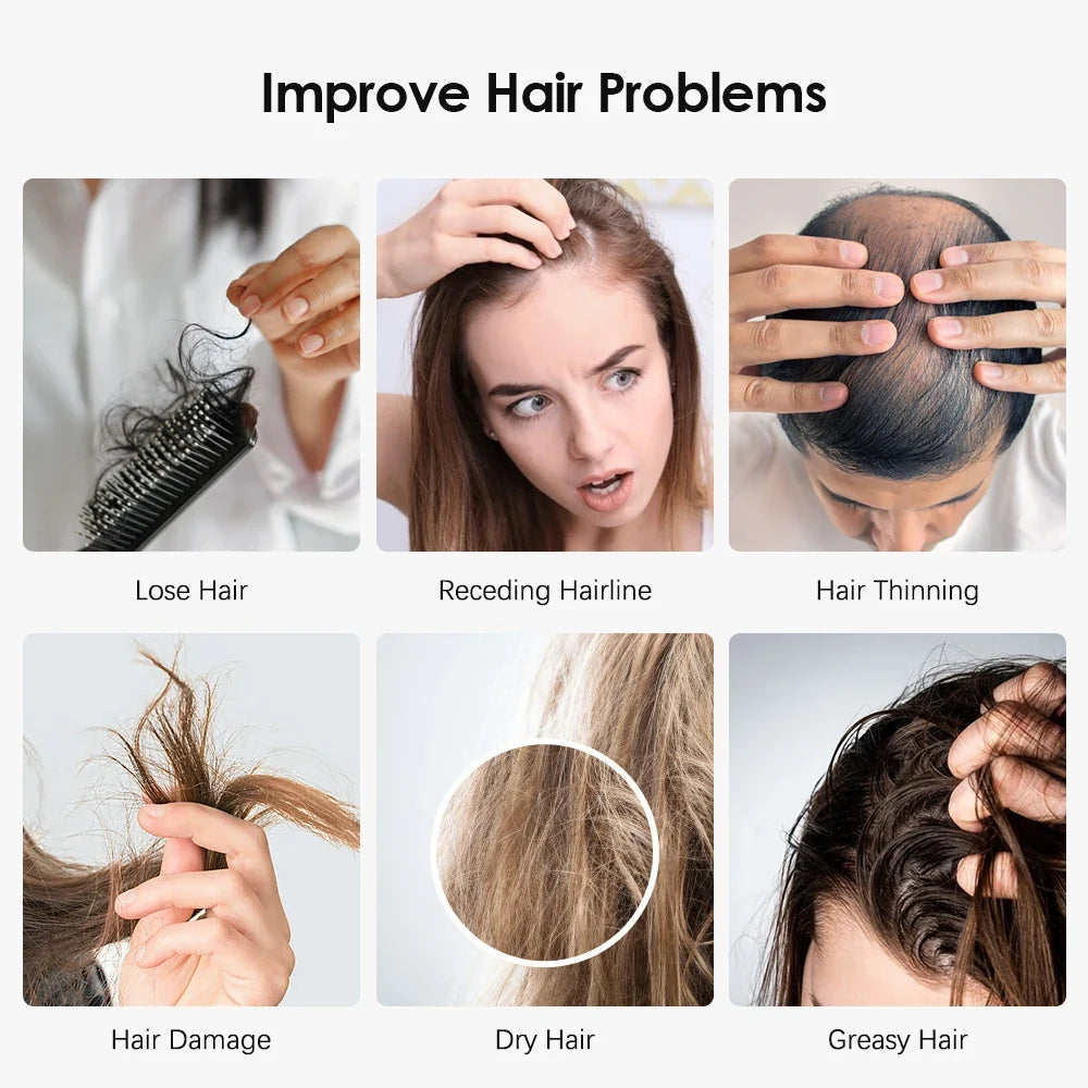 Electric Scalp Massager